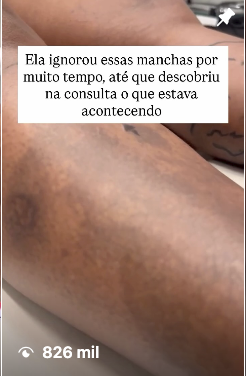Resultado 5